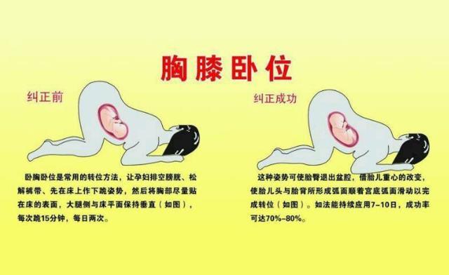 你的育儿经：孕晚期，胎宝宝头朝下晕眩难受吗？为了见妈妈，胎儿其实很努力