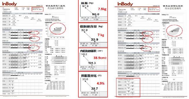 如何科学减肥？专家告诉你“肌”不可失