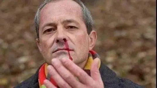 职业性鼻炎你知道多少？