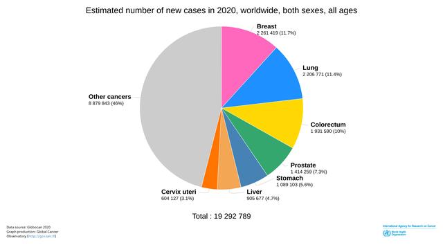 癌症|WHO发布最新癌症数据：乳腺癌取代肺癌成全球最常见癌症