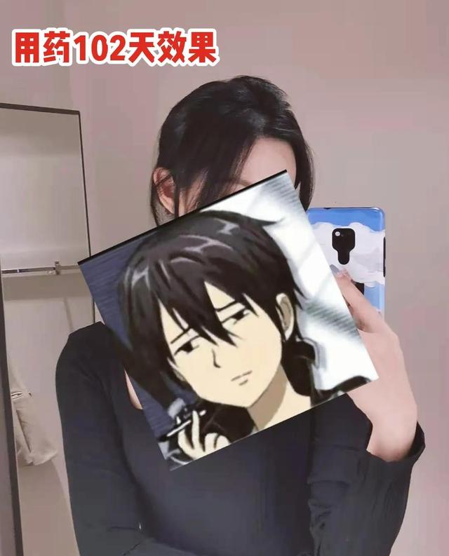 非那雄胺的真实有效率是多少（五位发友改善一年，终于告别稀疏）