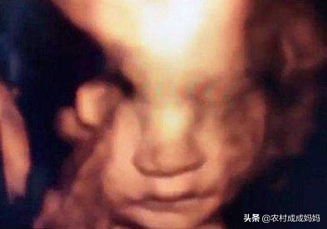 『超级宝妈』孕妇做四维彩超,发现孩子朝自己笑,正偷乐着,医生说打掉吧