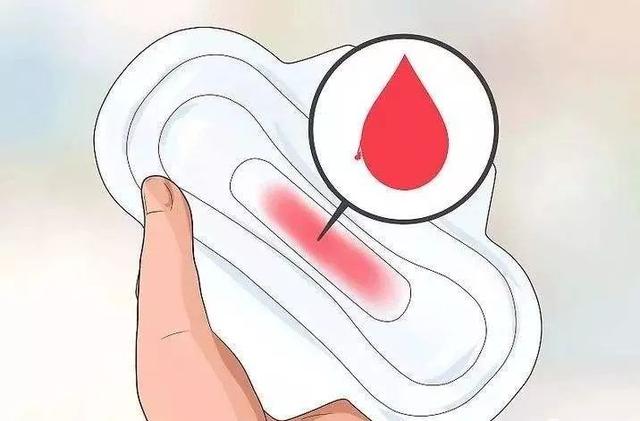 月经|月经量过多是不是一种疾病？要警惕这几种妇科病