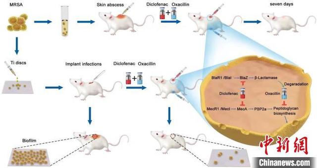 专家发现骨关节术后感染防治新策略：传统药物对抗超级耐药菌“显身手”