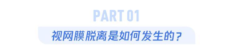 困扰艾芬医生的视网膜脱离，有3类人要格外留心