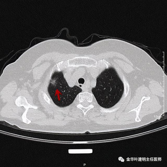 如此违反原则的手术方案设计，你支持吗？