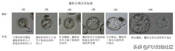 生活矜持点|试管婴儿胚胎评分和胚胎移植、冷冻、丢弃标准
