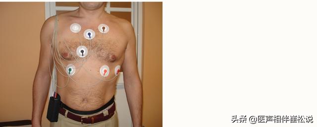 心电图|得了心脏病哪些检查最准确？这份“心脏检查指南”请收好！