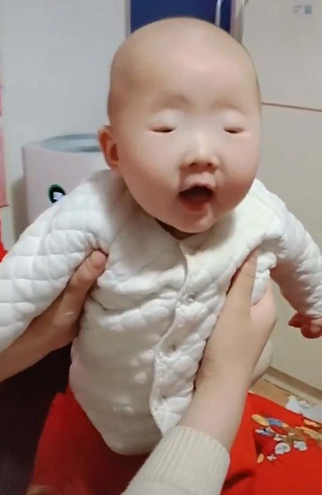 「你的育儿经」全网眼睛最小宝宝火了，眼珠只有“绿豆”般大小，李荣浩甘拜下风