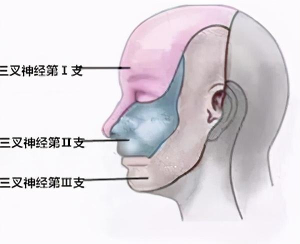 浅谈三叉神经痛的基本认识