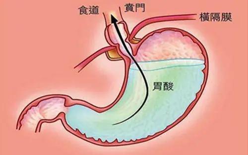 饭后一杯酸奶，能不能促进消化？