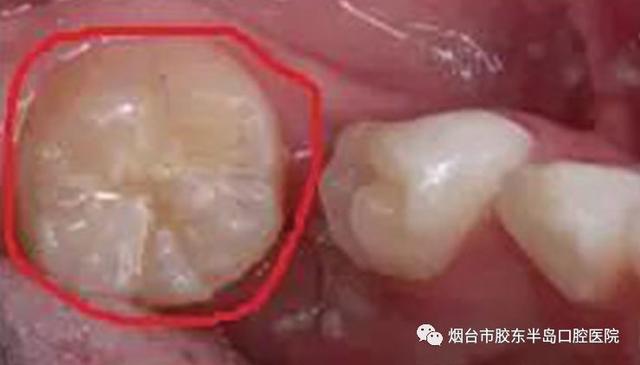 #你的育儿经#孩子不懂大人不在乎 有可能会影响孩子一生
