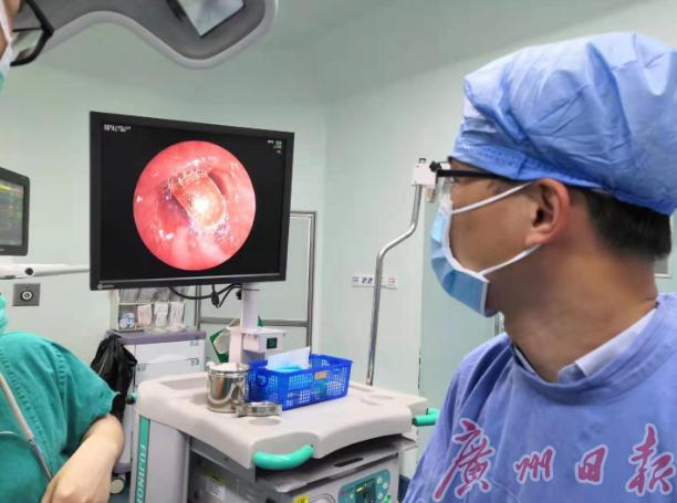 刘鸿|1月龄宝宝误吞金戒指，医生“巧手”10秒取出