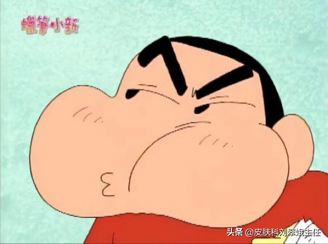 门诊案例 | 26岁女生染发染出祸，你清楚自己的过敏原吗？