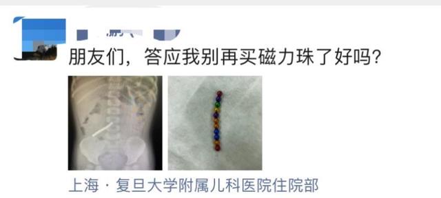 「超级宝妈」玩具选择应注意:2岁男孩误食11颗磁力珠造成肠穿孔