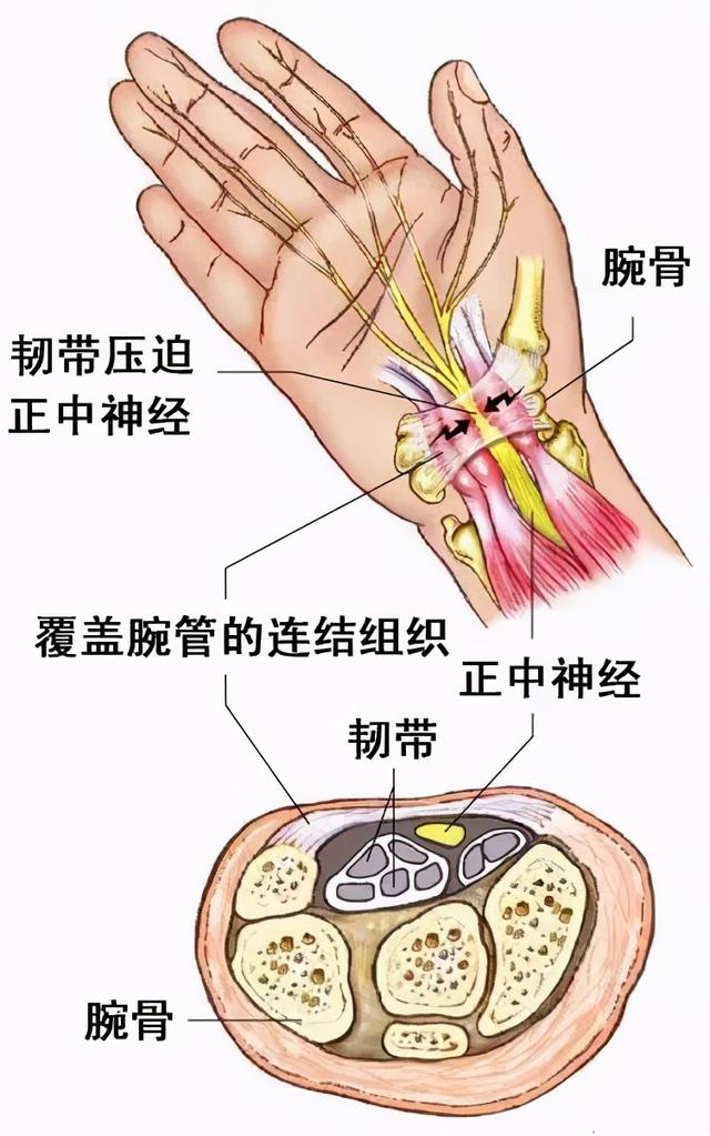 手麻、手疼、手无力，这下终于知道为什么了