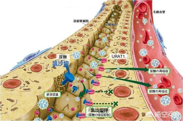 二甲双胍|降“三高”的药物里，哪些可以降尿酸？