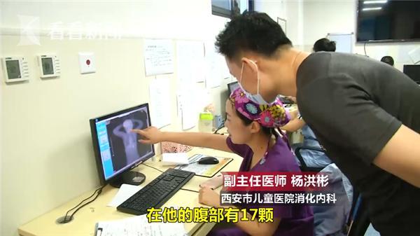 光明网|3岁娃误吞19颗磁力珠 怕爸妈责备竟说只吃了1颗