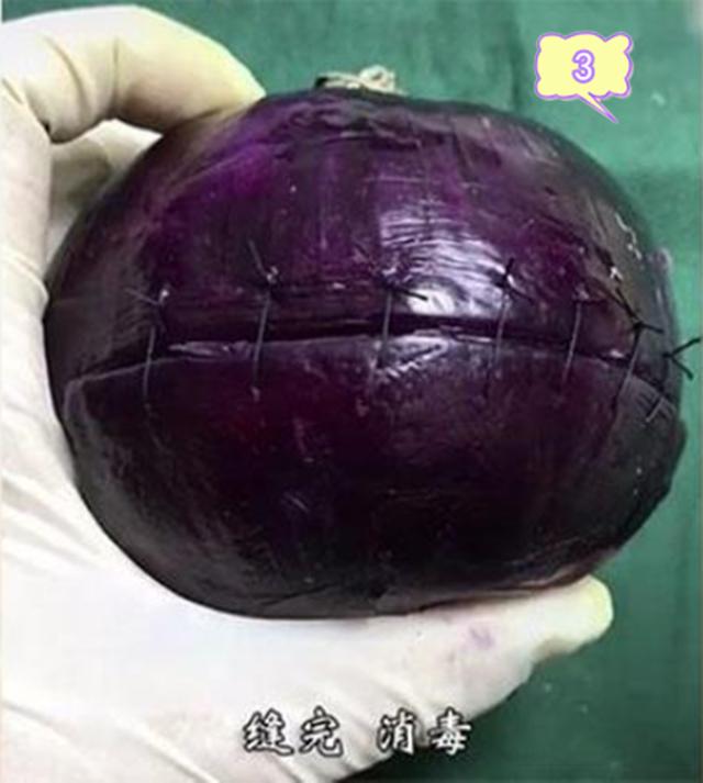【你的育儿经】网友用洋葱模拟生娃全过程，过来人：看着就疼，你准备好了吗