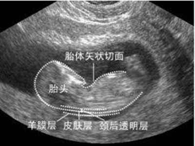 南浔的梦|孕期做几次B超检查为宜？准妈早做“计划”，做多恐对女宝有隐伤