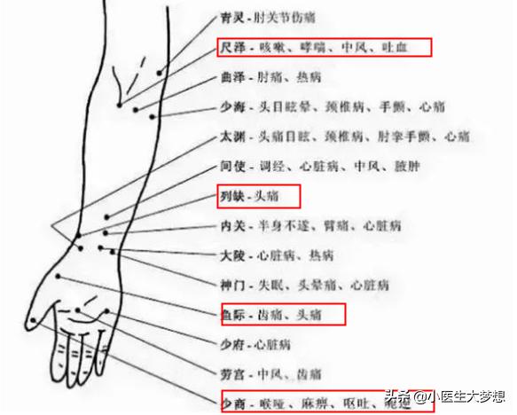 实践技能针灸常用90个腧穴位置图