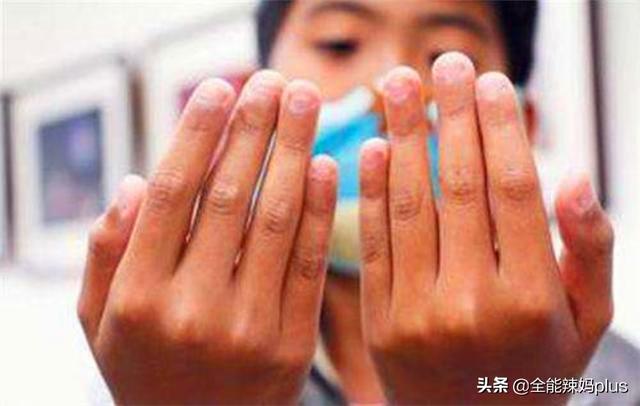 你的育儿经：从小爱啃手指的孩子，长大难逃这3种结局，你家孩子中了吗？