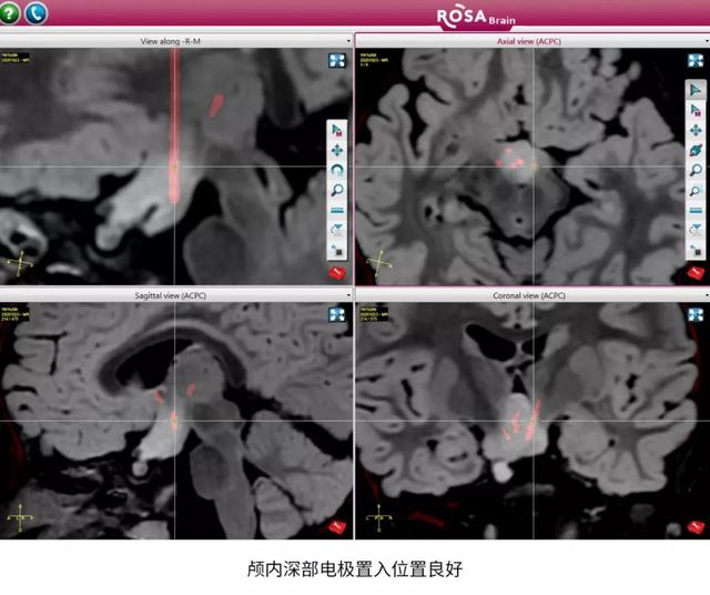 3岁女童性格好爱笑，但她的“微笑”却让父母操碎了心