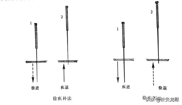 针灸常用补泻手法介绍，建议初学者收藏