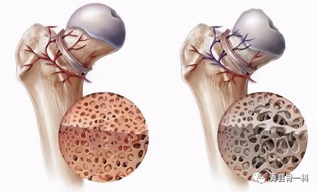 伤筋动骨一百天？医生表示恢复时间还需要看受伤位置