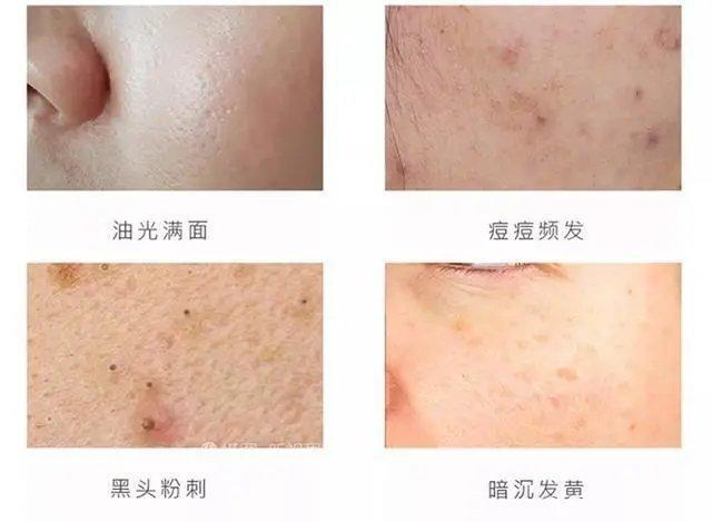你的育儿经▲应采儿不愧是“最正辣妈”，孕期素颜嫩如水，自曝孕期保养秘籍