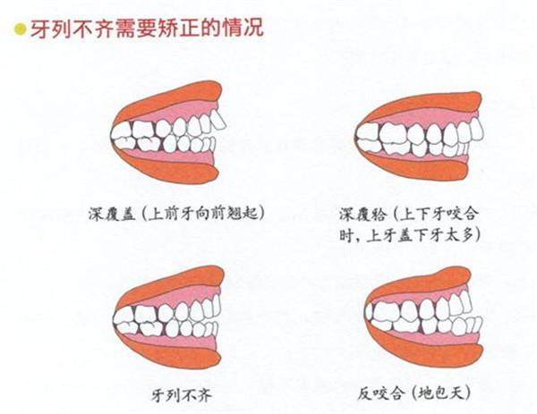 郑州德韩口腔做牙齿矫正怎么样？