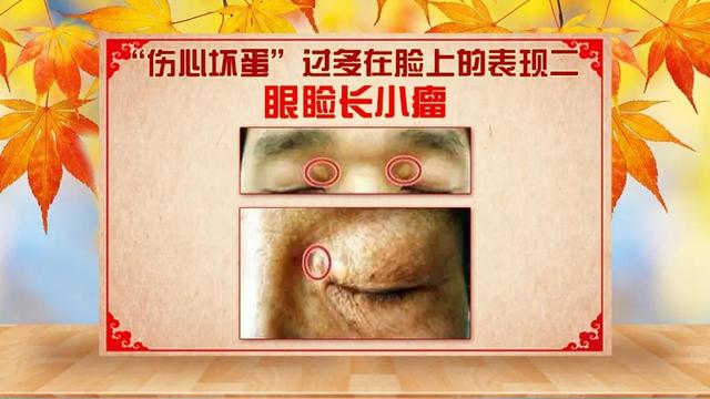 胆固醇|眼睛、耳朵出现这种变化，可能是血管中“坏胆固醇”增多了