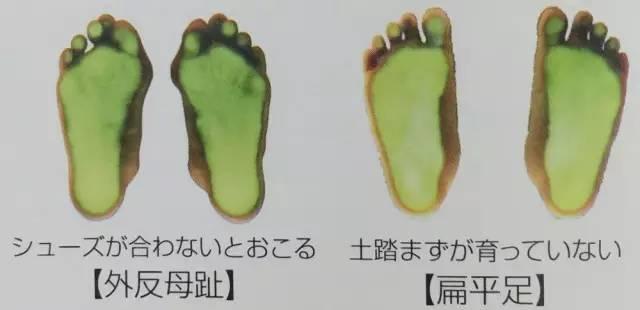 超级宝妈|寒从脚起 夏天也要穿袜子?百年鞋厂建议孩子10岁前尽量不穿鞋