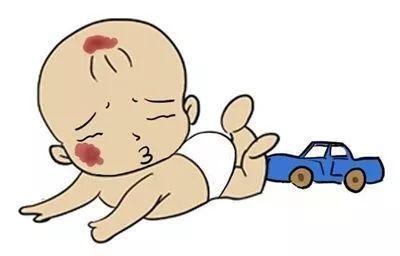 皮肤|带您了解皮肤肿瘤