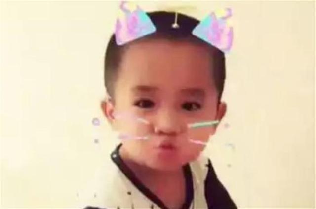你的育儿经▲还记得被宝妈用剪刀划伤脸的男婴吗？4年后孩子的现状令人欣慰