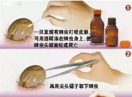 「你的育儿经」注意！身上出现这个“黑点”非常危险，六安已有人中招...