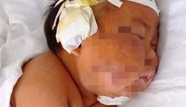 【你的育儿经】还记得四年前被妈妈用剪刀划成“花脸猫”的男婴吗？如今已成这样