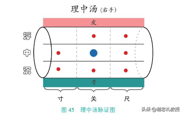 治疗冠心病，见到这个脉象就用理中汤