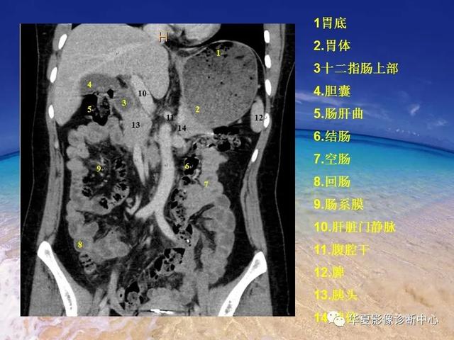 消化道穿孔的CT诊断