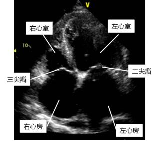 心脏超声怎么做？有什么用？有害吗？