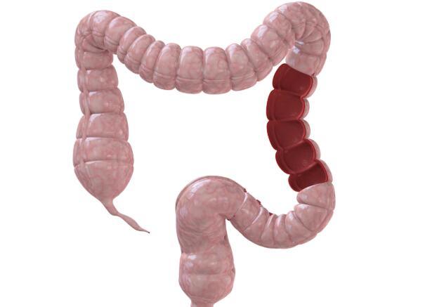 病从口入！医生告诫：4个饮食习惯让你“吃”出癌症，趁早改正