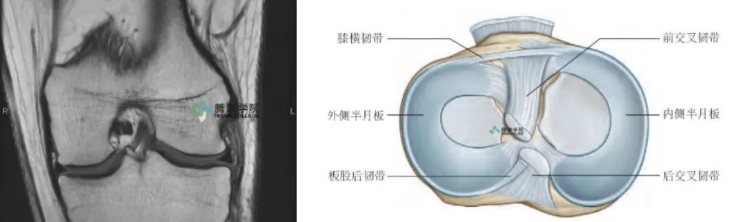 膝关节解剖及常见损伤
