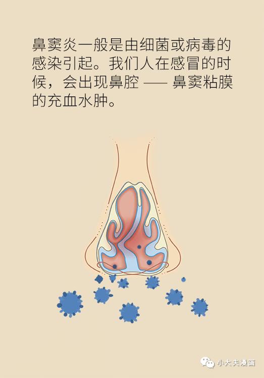 鼻子堵总不好，可能因为生活中这个恶习！