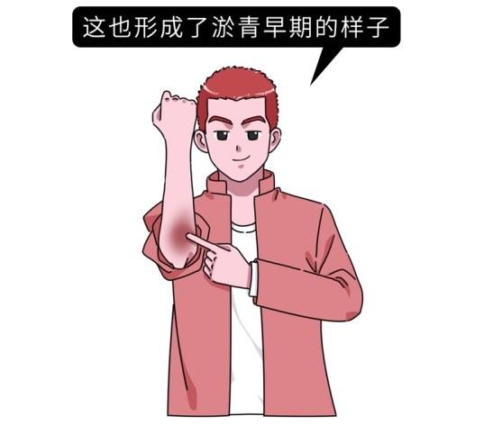 女生的膝盖总是有淤青，背后的原因是什么？为什么男生很少有？