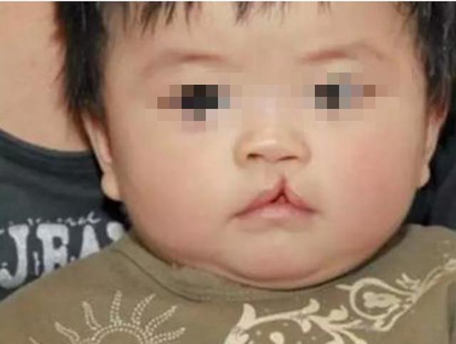 「超级宝妈」20年前，妈妈嫌弃孩子的“兔唇”，丢掉3岁女儿，如今很后悔