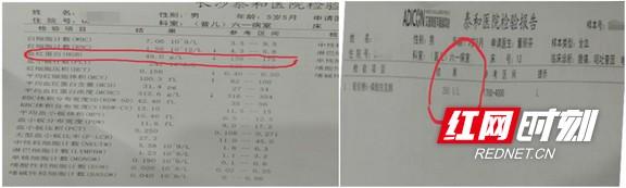 红网@5岁男孩偷吃蚕豆 重度贫血、呕吐、发烧……太危险