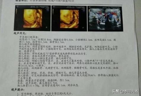 你的育儿经|怀孕最后一个月,胎儿能长多少斤?不清楚的孕妈,不妨了解下