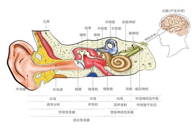 如何让听力回归双耳