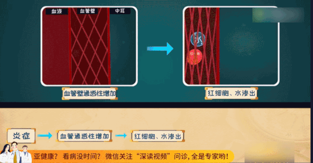 「超级宝妈」2岁男孩总挠头，险酿大祸！医生：都是中耳炎惹的祸！