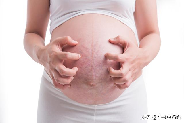 春风▲婆婆会看懂肚子上的妊娠线?妊娠纹的预防和注意方法,孕妇需了解
